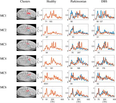 Complex network measures reveal optimal targets for deep brain stimulation and identify clusters of collective brain dynamics
